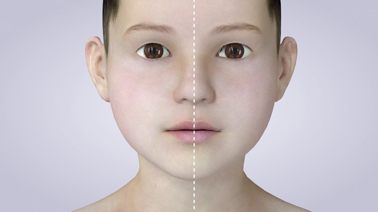 Poster image for the Kids' Oral Habits patient-education video